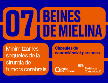 Episodio 7 - Minimizar las secuelas de la cirugía de tumores cerebrales