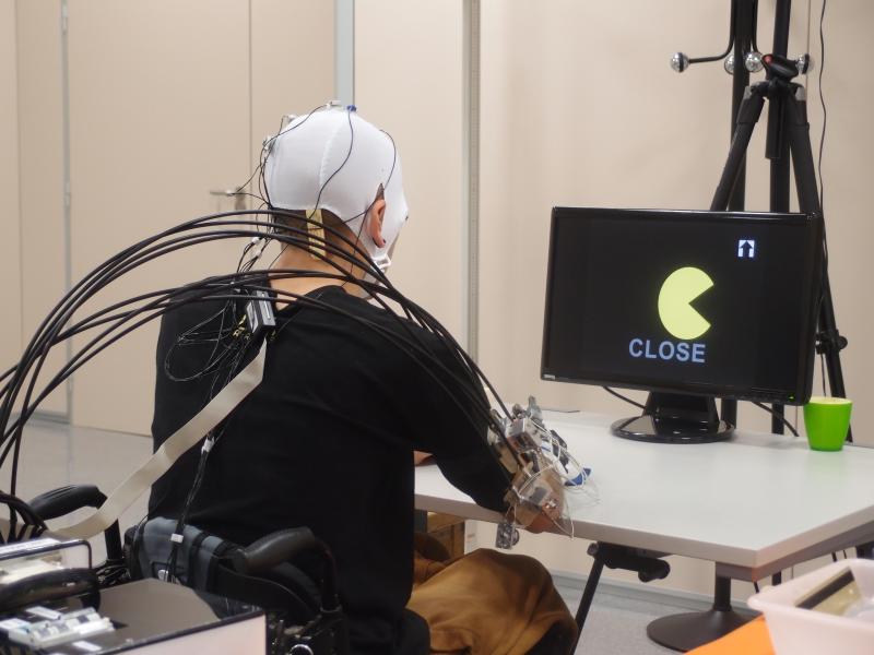 f1.jpg Noticias Institut Guttmann - joven tetraplégico recupera el control de una mano
